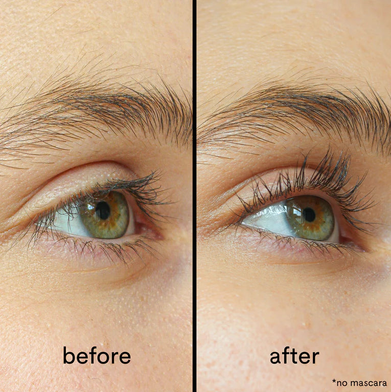 Toplotni uvijalec trepalnic