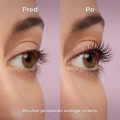 Toplotni uvijalec trepalnic